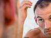 Natural Hair Loss Treatment for Men – It Is Very Simple and Easy to Apply Them