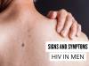 Signs and Symptoms of HIV in Men