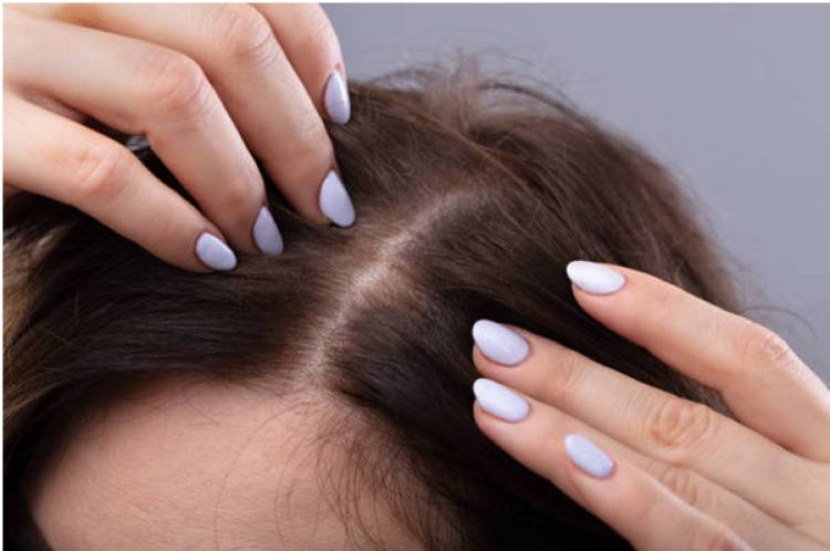 What are the Best Treatments for Female Hair Thinning?